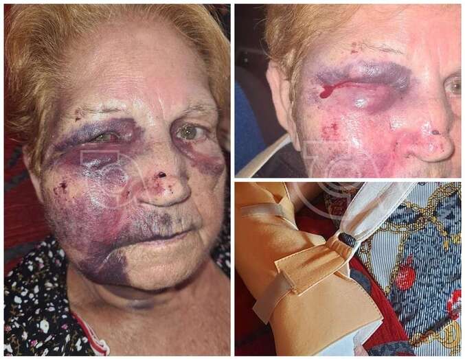 María del Pino Carreño Benítez se recupera en su domicilio de las lesiones sufridas a consecuencia de la caída/TA.